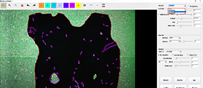 GBOS Deep larning Al model